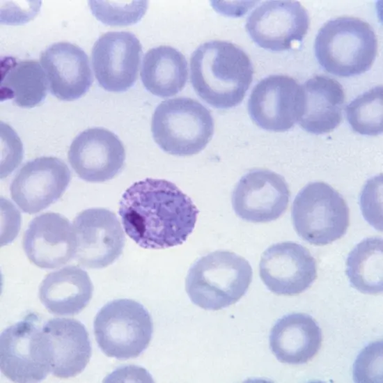 Malaria Antigen (Vivax and Falciparum)